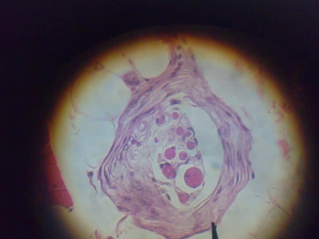 Los organos tendinosos de golgi